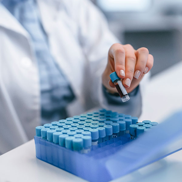 Scientist in lab sorting vials into a holder to prepare for storage.