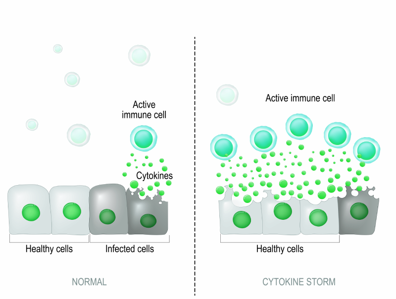 Cytokine Storm